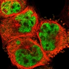 Immunofluorescent staining of human cell line A-431 shows localization to nuclear speckles.