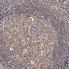 Anti-UPF3B Antibody