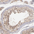 Immunohistochemical staining of human testis shows moderate cytoplasmic positivity in cells in seminiferous ducts.