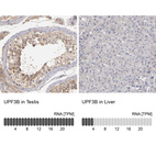 Immunohistochemistry analysis in human testis and liver tissues using HPA001882 antibody. Corresponding UPF3B RNA-seq data are presented for the same tissues.