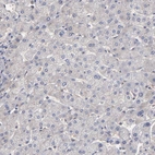Immunohistochemical staining of human liver shows no positivity in hepatocytes as expected.