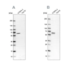 Western blot analysis using Anti-UPF3B antibody HPA001882 (A) shows similar pattern to independent antibody HPA001592 (B).
