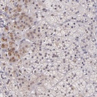 Anti-NUP62CL Antibody