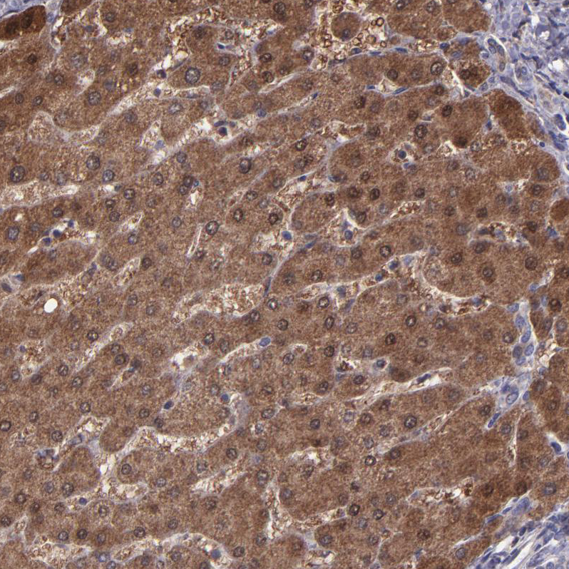Anti-SERPINF2 Antibody