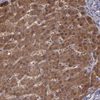 Anti-SERPINF2 Antibody