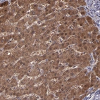 Anti-SERPINF2 Antibody