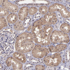 Anti-SERPINF2 Antibody