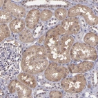 Immunohistochemical staining of human kidney shows moderate cytoplasmic positivity in cells in tubules.