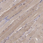 Immunohistochemical staining of human skeletal muscle shows moderate cytoplasmic positivity in myocytes.