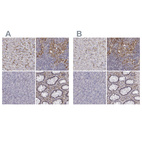 Immunohistochemical staining of human liver, lymph node, pancreas and rectum using Anti-CD14 antibody HPA001887 (A) shows similar protein distribution across tissues to independent antibody HPA002127 (B).