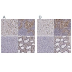 Immunohistochemical staining of human liver, lymph node, pancreas and rectum using Anti-CD14 antibody HPA001887 (A) shows similar protein distribution across tissues to independent antibody HPA002127 (B).