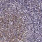 Immunohistochemical staining of human tonsil shows moderate membranous positivity in germinal center cells.