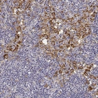 Immunohistochemical staining of human lymph node shows moderate to strong membranous positivity in lymphoid cells.