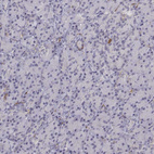 Immunohistochemical staining of human pancreas shows no cytoplasmic positivity in exocrine glandular cells as expected.