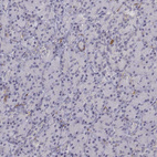 Anti-CD14 Antibody