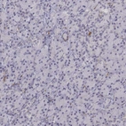 Immunohistochemical staining of human pancreas shows no cytoplasmic positivity in exocrine glandular cells as expected.