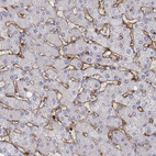 Immunohistochemical staining of human liver shows moderate to strong membranous positivity in hepatic sinusoid cells.