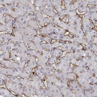 Immunohistochemical staining of human liver shows moderate to strong membranous positivity in hepatic sinusoid cells.