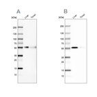 Western blot analysis using Anti-CD14 antibody HPA001887 (A) shows similar pattern to independent antibody HPA002127 (B).