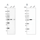Western blot analysis using Anti-CD14 antibody HPA001887 (A) shows similar pattern to independent antibody HPA002127 (B).