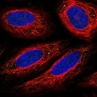 Immunofluorescent staining of human cell line SiHa shows localization to vesicles.
