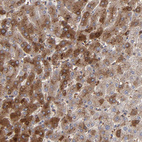 Immunohistochemical staining of human liver shows weak to moderate cytoplasmic positivity in hepatocytes.