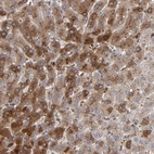 Immunohistochemical staining of human liver shows weak to moderate cytoplasmic positivity in hepatocytes.
