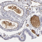 Immunohistochemical staining of human fallopian tube shows moderate positivity in plasma.