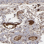 Anti-LRG1 Antibody