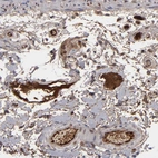 Immunohistochemical staining of human colon shows weak to moderate positivity in plasma.
