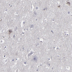 Immunohistochemical staining of human cerebral cortex shows very weak cytoplasmic positivity in a subset of neurons.