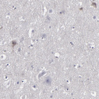 Anti-LRG1 Antibody