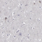 Immunohistochemical staining of human cerebral cortex shows very weak cytoplasmic positivity in a subset of neurons.