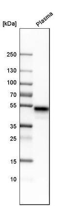 Western blot analysis in human plasma.
