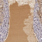 Immunohistochemical staining of plasma in human liver shows moderate cytoplasmic positivity.