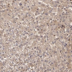 Immunohistochemical staining of human liver shows moderate cytoplasmic positivity in hepatocytes.
