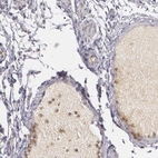 Immunohistochemical staining of human fallopian tube shows moderate cytoplasmic positivity in plasma.