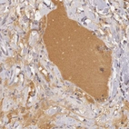 Immunohistochemical staining of human duodenum shows moderate cytoplasmic positivity in plasma.
