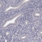 Anti-LRG1 Antibody