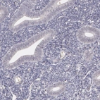 Immunohistochemical staining of human endometrium shows no cytoplasmic positivity in glandular cells as expected.