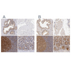 Anti-PRKCD Antibody