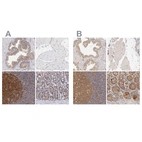 Immunohistochemical staining of human prostate, skeletal muscle, tonsil and upper gastrointestinal using Anti-PRKCD antibody HPA001890 (A) shows similar protein distribution across tissues to independent antibody HPA001863 (B).