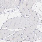 Immunohistochemical staining of human skeletal muscle shows no positivity in myocytes as expected.