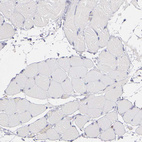 Anti-PRKCD Antibody