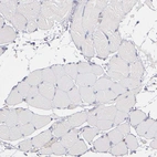 Immunohistochemical staining of human skeletal muscle shows no positivity in myocytes as expected.