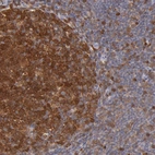 Immunohistochemical staining of human tonsil shows strong cytoplasmic positivity in germinal center cells.