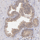 Immunohistochemical staining of human prostate shows moderate cytoplasmic positivity in glandular cells.