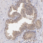 Immunohistochemical staining of human prostate shows moderate cytoplasmic positivity in glandular cells.