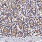Immunohistochemical staining of human duodenum shows weak to moderate cytoplasmic positivity in glandular cells.