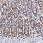 Immunohistochemical staining of human duodenum shows weak to moderate cytoplasmic positivity in glandular cells.